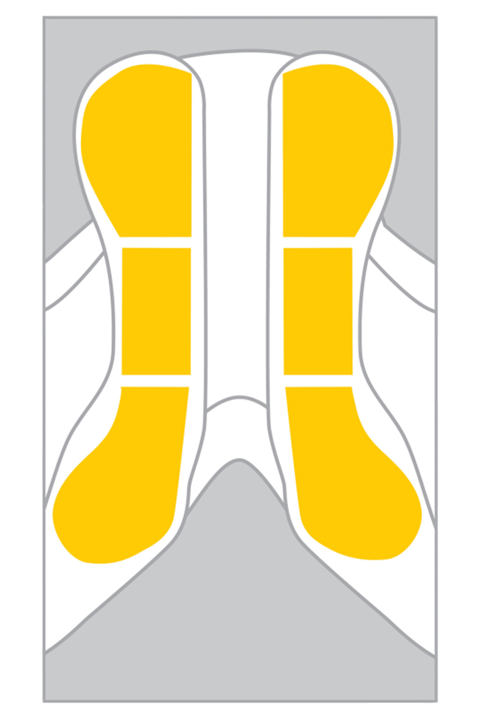 Wintec Easy-Change Riser Zestaw startowy, Standard